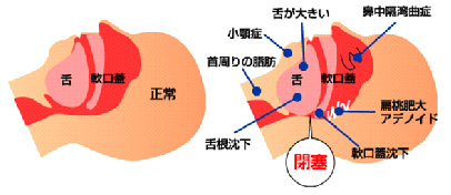 なごや耳鼻咽喉科